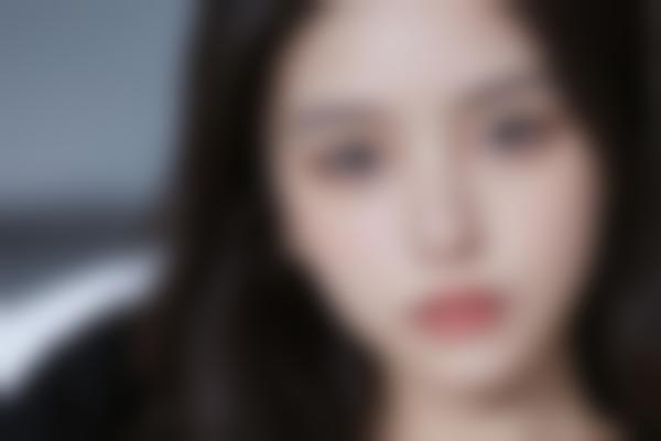 郑州段珊珊医生骨相轻薄面打造怎么样？段珊珊医生注射技术2万起让面部自然又年轻!