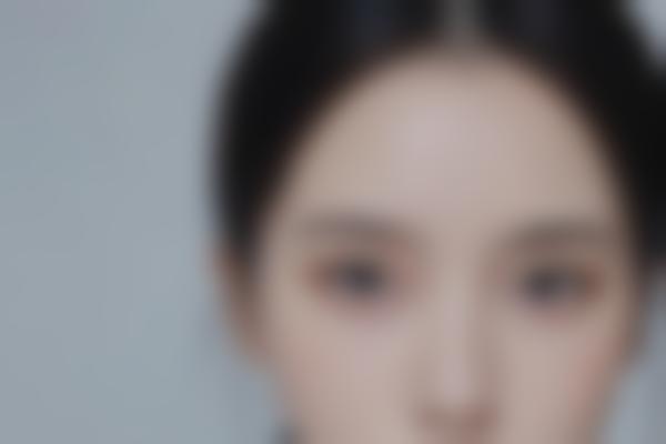 4、胸部整形兼顾形态与