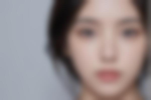 西宁李生梅医生皮肤美容修复好,李生梅医生微整形3D让皮肤年轻化显著!
