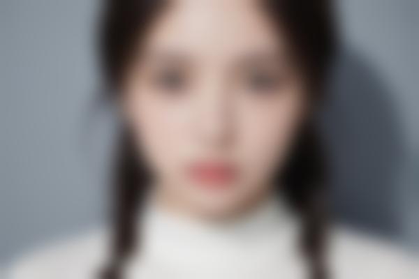 上海李强双眼皮修复好，李强院长美眼整形技术让眼部自然灵动真的绝！