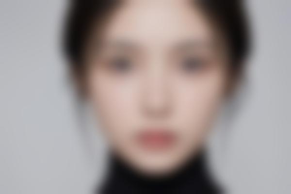 潘彦龙双眼皮修复技术有多强？