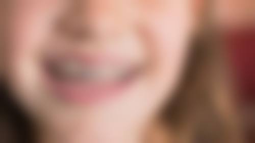 郑凤娇医生简介项目优势