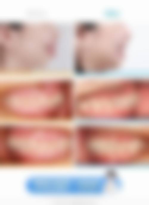 宁波海曙牙管家综合整形门诊部特色项目怎么样