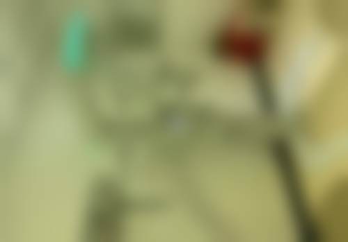 易平良医生做手术价格