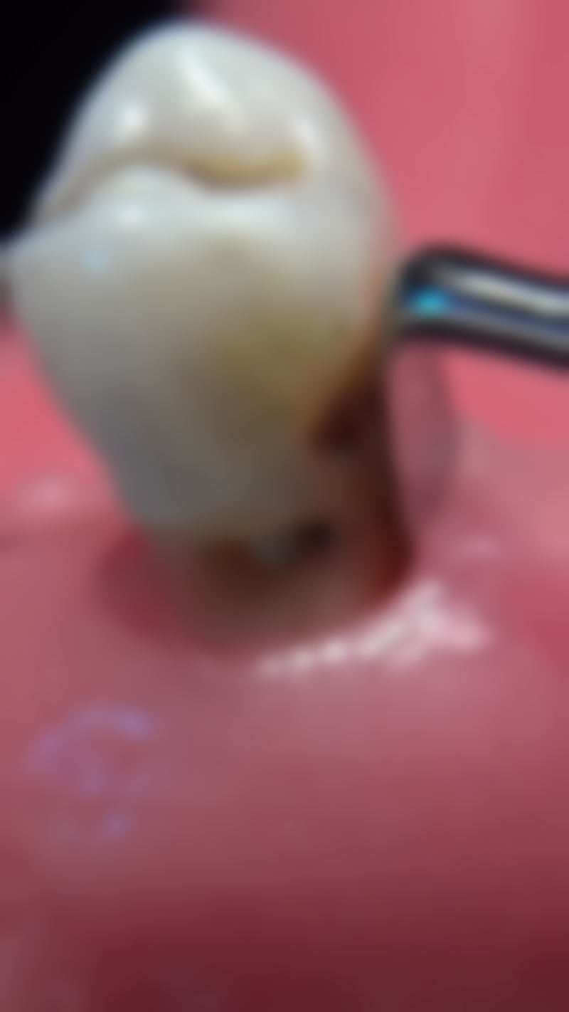 孔祥红医生简介做手术价格