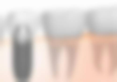 七、金华市中 心医院口腔科口碑好不好：真实患者口碑见证实力