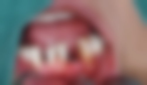 江苏南京万泰口腔抖音团购活动及价格表