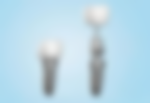 半口种植牙三大优势：精打细算者的福音