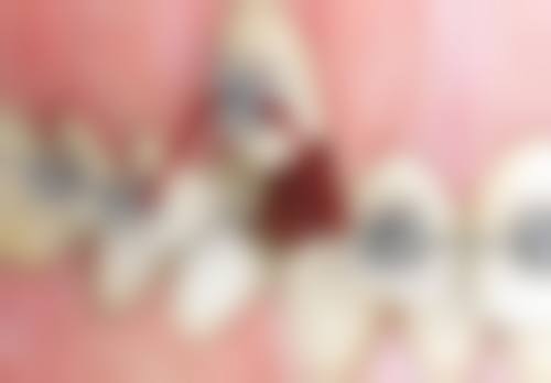 苏州牙博士口腔门诊部顾客实例