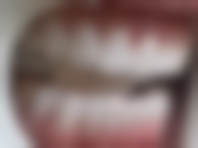 什么叫种植牙种植牙之价格大揭秘