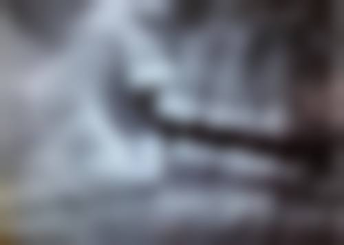 种植牙种植体与植骨可以同时进行吗？北京上海广州三甲医院专家解析关键条件