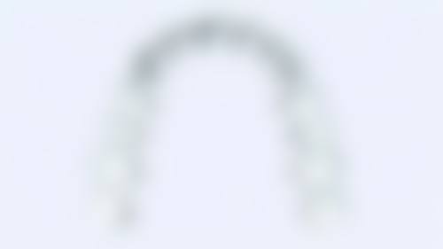 【金属非自锁托槽矫正+9999】口碑与评价