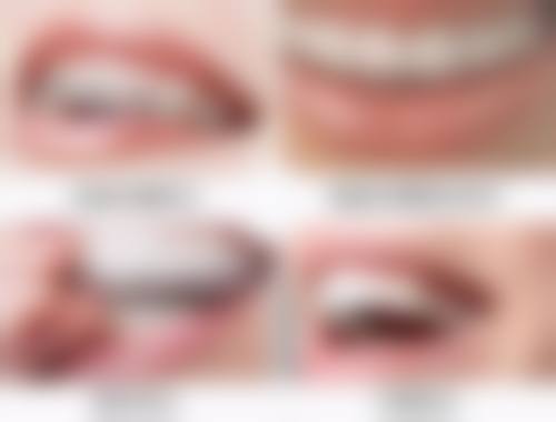 士卓曼种植牙价格是怎么样的：明码标价与隐藏消费全解析