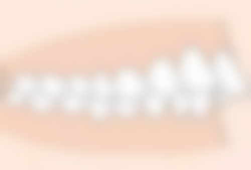 种植牙多大年龄不能种？18岁以下慎选，80岁老人也能种牙！