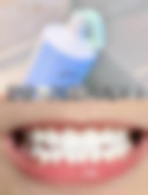 北京市正规的口腔医生排名下金属托槽矫正的高性价比之选