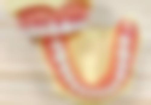 拔牙多久后才可以种植牙——影响种植时机的关键因素