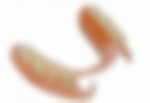 拔牙多久后才可以种植牙——如何确定你的至佳种植时间