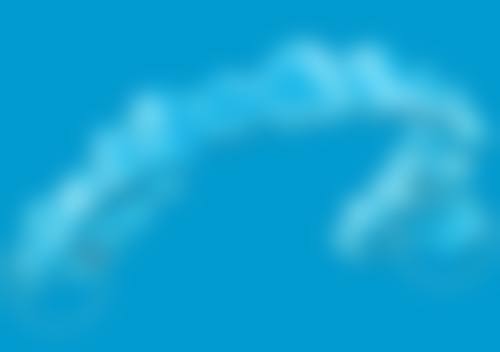 种植牙常见Q&A:解答你的疑惑