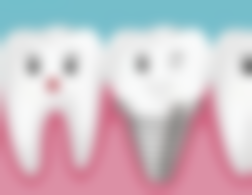 老年人种植牙怎么选:适合老年人的种植体与医院