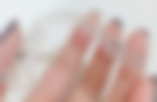 门牙掉了半年做种植牙的具体情况