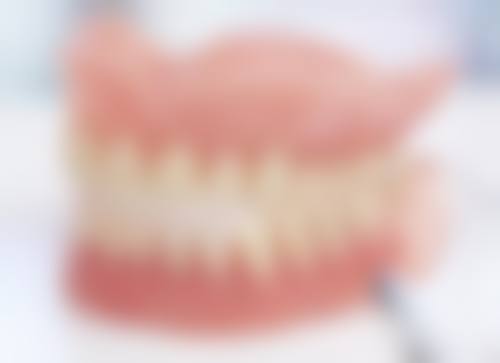 装了活动义齿后种牙：时间规划