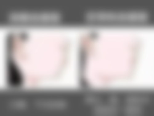 种植牙和镶牙哪个好？教你选靠谱医院和医生