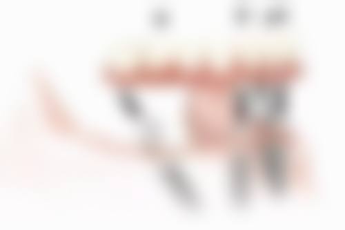 金秋十月,拔牙种植牙正当时——开启健康牙齿新旅程