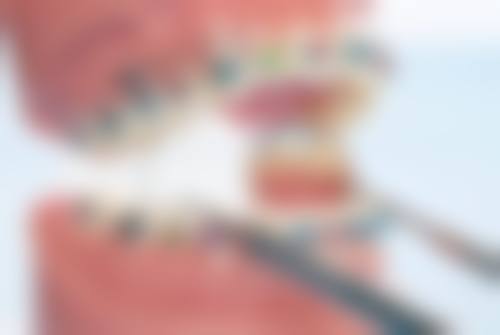 种植牙机器什么品牌好之国产雅客智慧崛起剖析