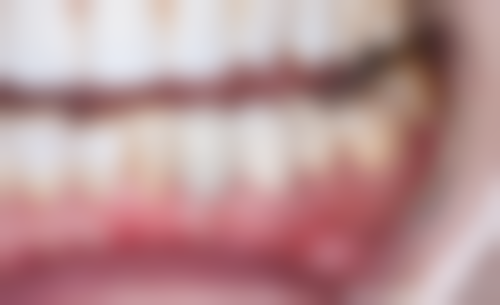 七、宁波尚恩口腔口碑情况介绍