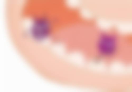 种植牙才1000元靠谱吗？正规医院价格大揭秘