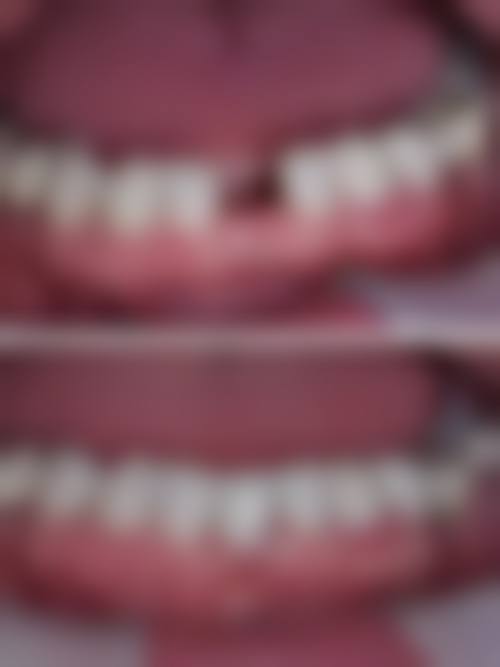 宁夏银川永宁县艾美乐口腔诊所可靠吗