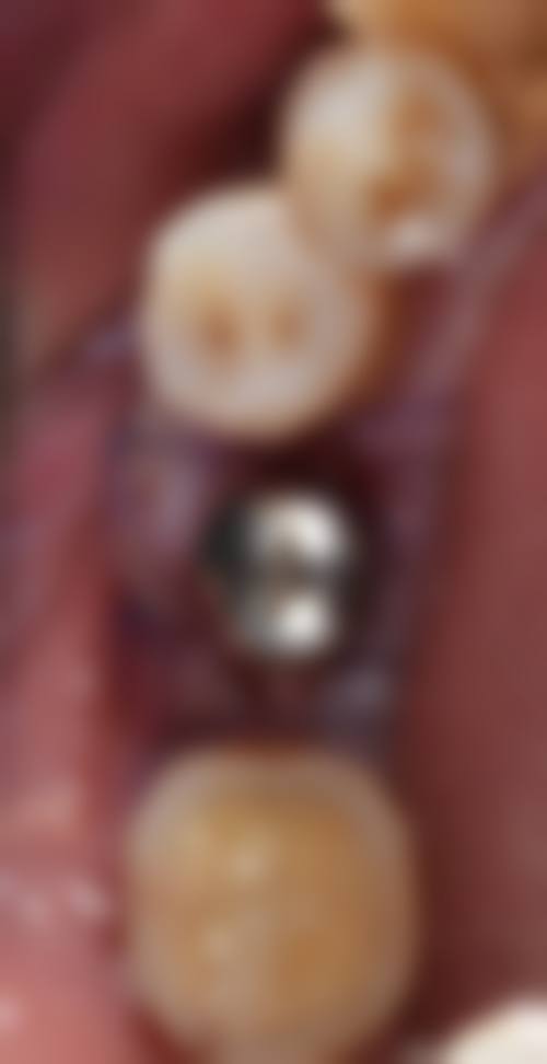 广东肇庆四会拜伦口腔正规吗?