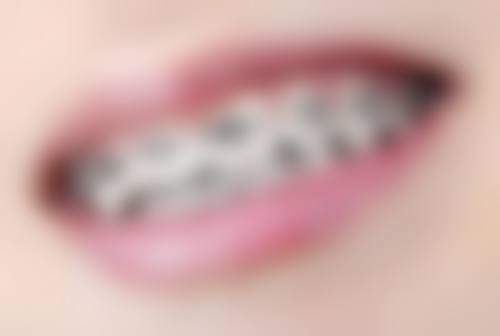 上海种植牙明星医院的精良技术与效率高体验