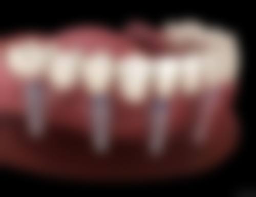 赵桐研医生简介做手术价格