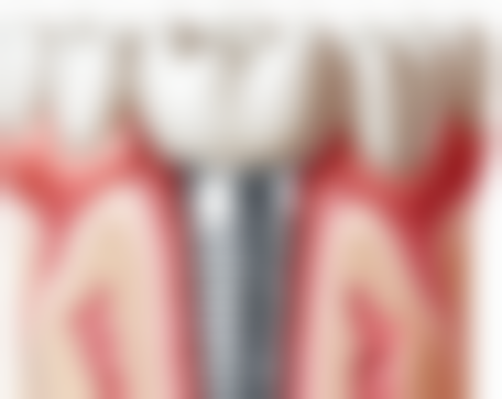 广东深圳胡婷口腔诊所怎么样评价