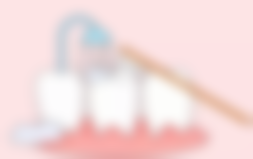 种植牙多久换一次牙冠之延长牙冠寿命终极指南