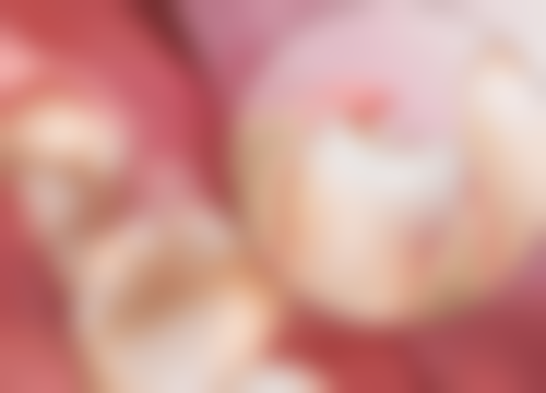 拔牙立即种植之健康牙龈组织条件论证