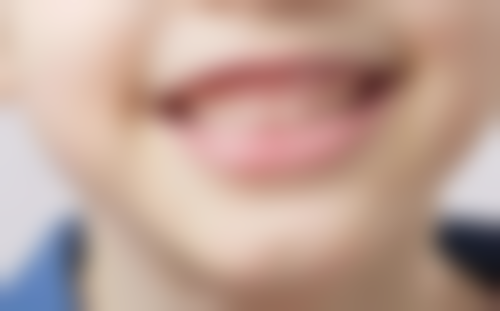 四、种植牙和烤瓷牙在舒适度体验上有什么区别——真牙VS假牙的终极PK