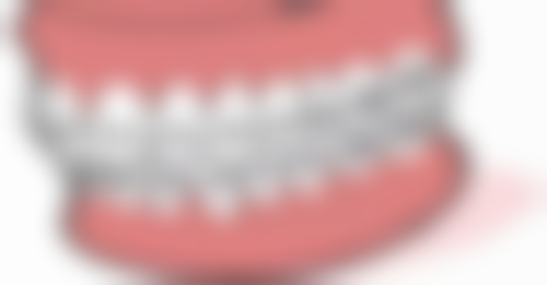 高端种植牙品牌性价比：高价背后的价值体现