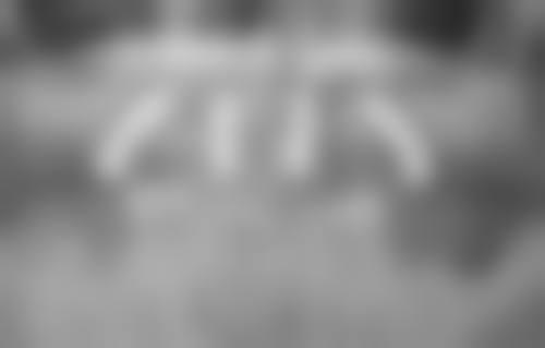 什么情况全口种植牙——牙周炎引发的缺牙危机