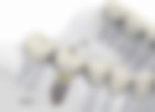 广东广州雅光口腔正规吗