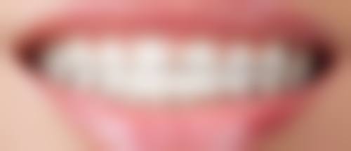 【时代天使隐形矫正+22000】杭州杭里口腔门诊部预约方式