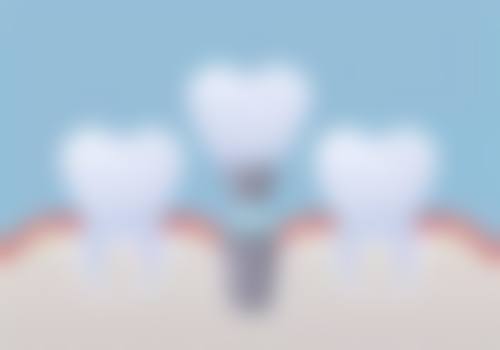 俊齿口腔门诊部顾客实例