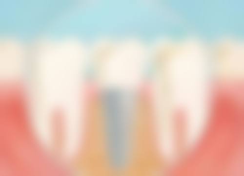 八、长沙暄美齿科侯家塘门诊怎么样,有抖音团购活动吗,价格表如何?