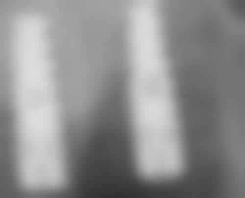 安徽淮北濉溪县吕家琦口腔口碑好不好