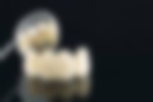 半口种植牙要种多少颗？4-6颗效果最佳，2颗也能种但需评估！