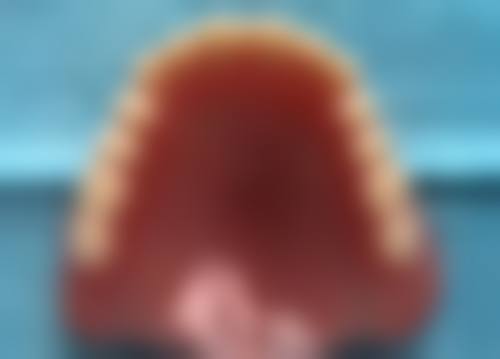 种植牙哪个品牌好一些之国产新势力的崛起