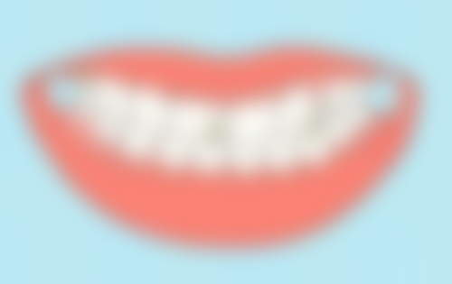 深圳韩国奥齿泰种植牙的数字化魅力与优势