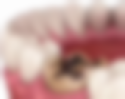 牙拔后多长时间可镶种植牙——拔牙后一个月能种植吗？医生揭秘真相