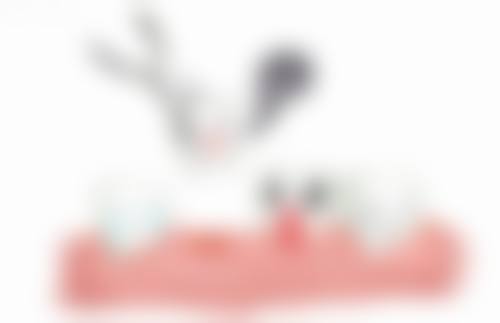 种植牙齿和安假牙有区别吗：适合人群大不同